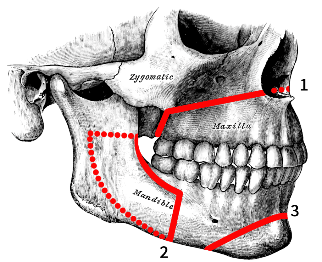 MCPS Dental anatomy